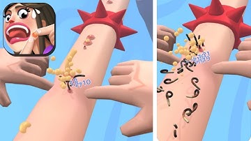 Acne Runner Gameplay Walkthrough  (IOS) | Snack Game