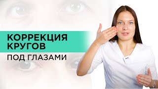 Как ИЗБАВИТЬСЯ от кругов под глазами? Методы устранения