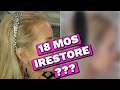 HOW TO CURE THINNING HAIR NATURALLY | SEE MY IRESTORE 18 MONTHS RESULTS | FOLLOW MY HAIR GROWTH