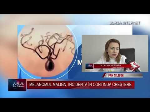 Video: Melanomul Mucoasei: Stadializare, Rate De Supraviețuire și Simptome