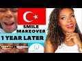 Dental centre turkey  smile makeover