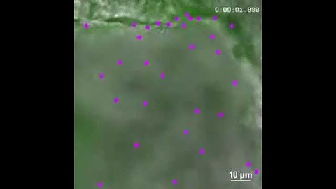 Green fluorescent microbeads flow recording in the Spag17Pcdo/Pcdo aqueduct of Sylvius.