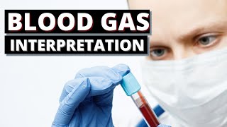 How To Interpret A Blood Gas Result At Medical School