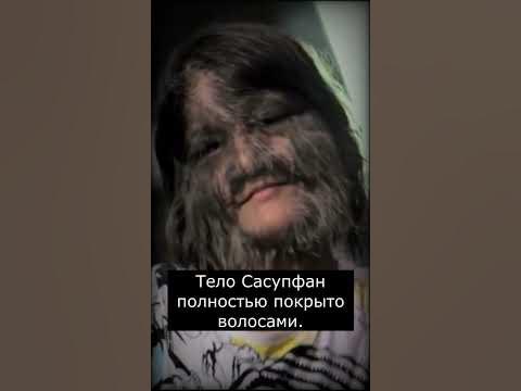 Самая Волосатая Девушка в Мире - YouTube