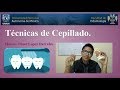 Técnicas de cepillado