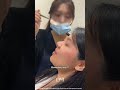 Nose job compilation? #koreanplasticsurgery #nosereshape #korean #koreanskincare #beauty #kbeauty