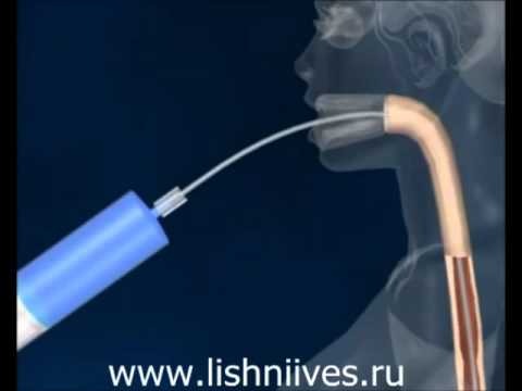 Как остановить жор и сесть на диету