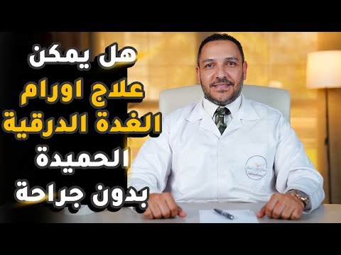 هل يمكن علاج اورام الغدة الدرقية الحميدة بدون جراحة