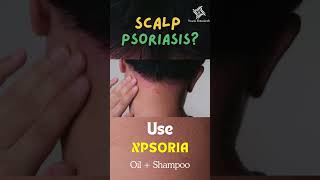 Best Shampoo and Oil for Scalp Psoriasis #psoriasisshampoo #scalppsoriasis #psoriasisoil Best Shampoo and Oil for Scalp Psoriasis #psoriasisshampoo #scalppsoriasis #psoriasisoil