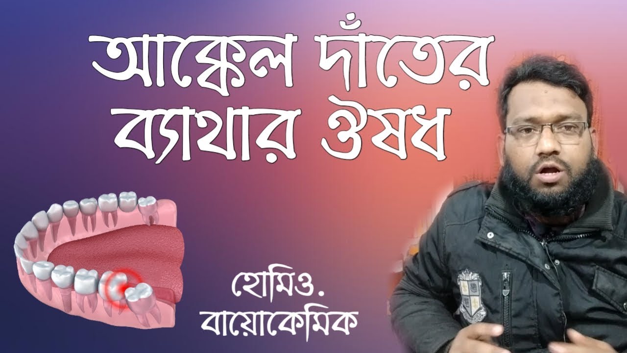 আক্কেল দাঁতের ব্যথা কমানোর হোমিও উপায় | Wisdom teeth pain homeopathy medicine