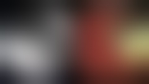 ERCP: Clip assisted cannulation of intradiverticular papilla