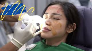 Jessica Iskandar Melakukan Operasi Hidung di Rumah Sakit Bedah Plastik Banobagi Korea Selatan