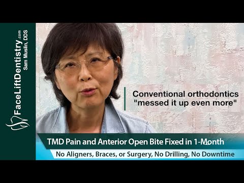 Anterior Open Bite