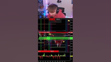 Trading With TradingView vs AlgoBox: Which One Wins?🏆💥 #trading #algobox #ninjatrader8 #daytrading