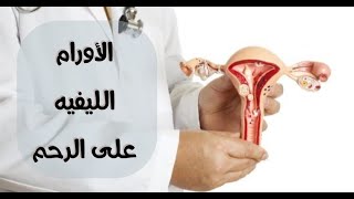 الأورام الليفية - أعراض الورم الليفي وعلاجه