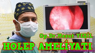 Op Dr Mesut Yesil Bursa Hasta Gorusleri Ve Iletisim Bilgileri Doktorsitesi Com