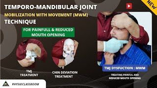 TMJ MOBILIZATION WITH MOVEMENT TECHNIQUE FOR TREATING PAINFUL AND REDUCED MOUTH OPENING