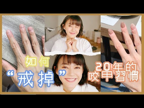 不私藏！如何戒掉 20年的咬指甲習慣！