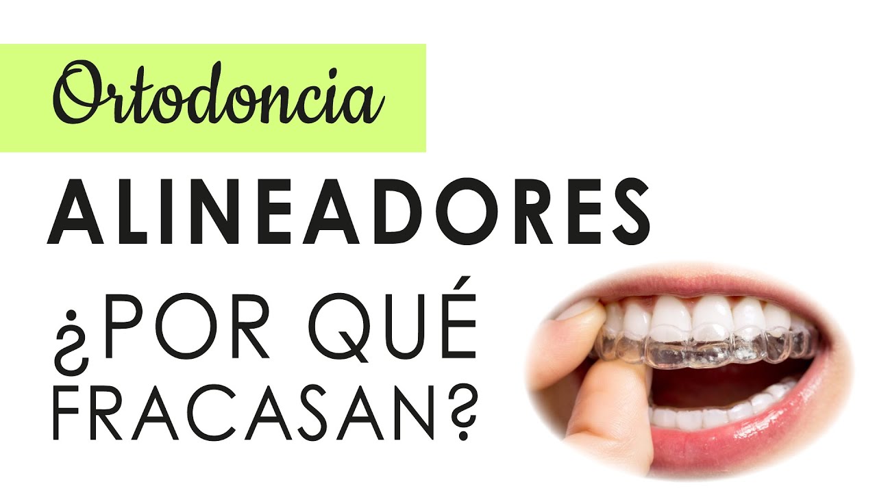 Cuanto cuesta un retenedor dental