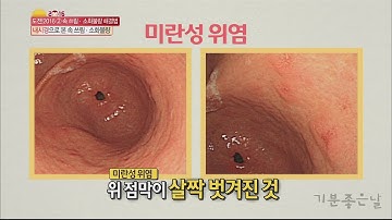 [Happyday] Antibiotics make gastritis 항생제, 진통제가 