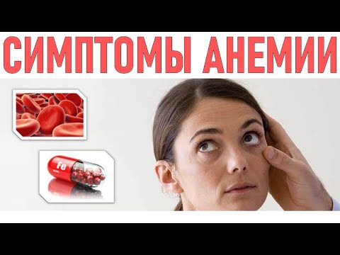 ОПАСНЫЕ СИМПТОМЫ АНЕМИИ | 6 симптомов железодефицитной анемии которые опасно игнорировать