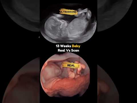 13 Weeks Baby
