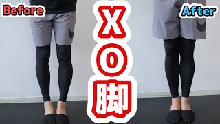 【XO脚矯正】スネの歪みが原因！プロだけが知る5分の簡単ストレッチでなおる【膝下O脚】
