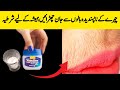 Unwanted facial hair remover  facial hair removal home remedy   skin naturally at home