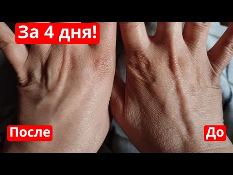 Омолодить и подтянуть кожу за 4 дня! И помолодеть на 10 лет! Недорогие аптечные средства для кожи.