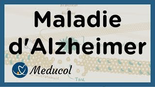 Alzheimer - Maladie Alzheimer : définition, symptômes, causes, stades, et traitement