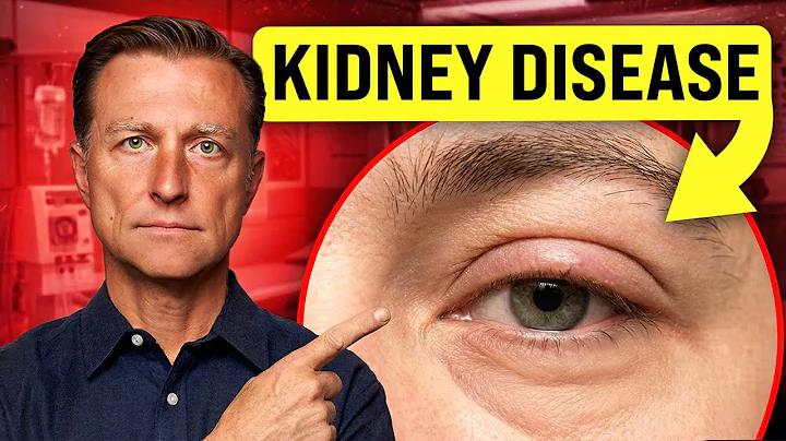 18 Visible Signs of Kidney Disease You Shouldn’t Ignore