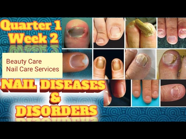 Figure 1 from An Integrated Deep Learning Framework Approach for Nail  Disease Identification | Semantic Scholar