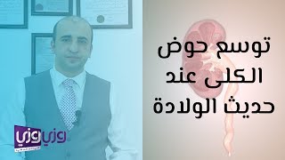 توسع حوض الكلى عند حديثي الولادة