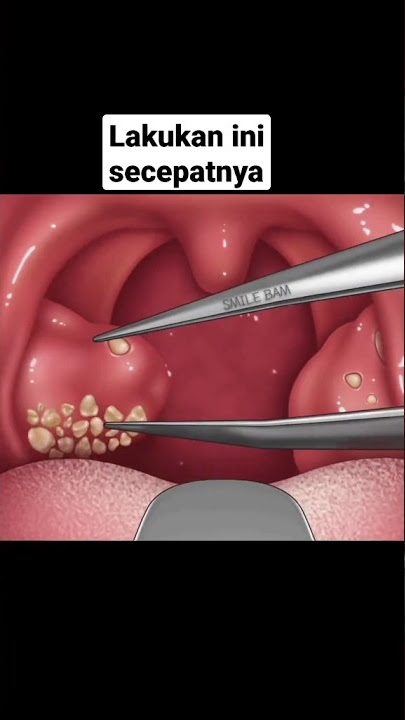 penyebab bau mulut #shorts