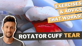 Rotator Cuff Tear Exercises & Tips for a Strong Recovery screenshot 2