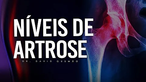 Como saber o grau da artrose no joelho?