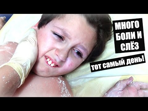 Video: Кичинекей Белена