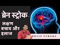 Brain Stroke in Hindi | ब्रेन स्ट्रोक- लक्षण बचाव और इलाज