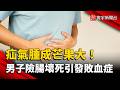 疝氣腫成芒果大！52歲男險腸壞死引發敗血症｜#寰宇新聞 @globalnewstw
