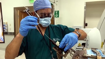 Lab Demo: Leksell Frame DBS and Intra Op CT - Francisco Ponce, MD