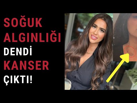 Lenf bezi şişmesi ile gitti, kanser çıktı