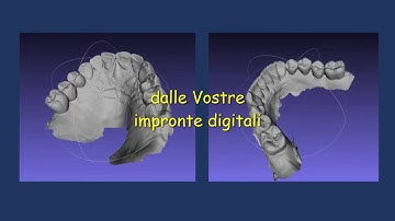 Orthorem Allineatori Invisibili