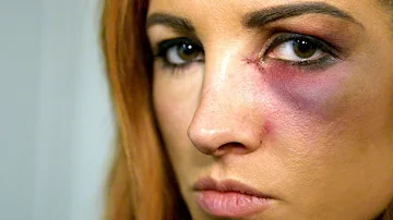 Becky Lynch learns she can't compete at Survivor Series: WWE The Day Of