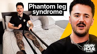 I Can Still Feel My Leg Thats Gone! | Amputee On Dealing With Phantom Limb Pain