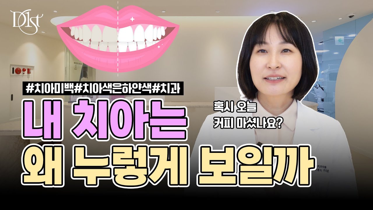 내 치아는 왜 누런색으로 보일까? I 치아미백 전 필수 시청