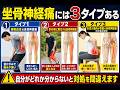 坐骨神経痛には3タイプある|自分がどれか分からないと対処を間違えます