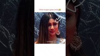 When Surgery Goes Wrong