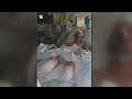 Man loses legs, hands to dangerous infection from dog saliva