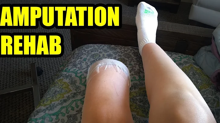 Pros & Cons: Rehabilitation Center after Amputation
