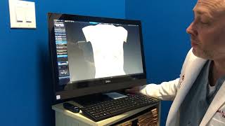 Vectra 3D imaging Showing Patient how it works | Board Certified Plastic Surgeon San Antonio, Texas Wealth